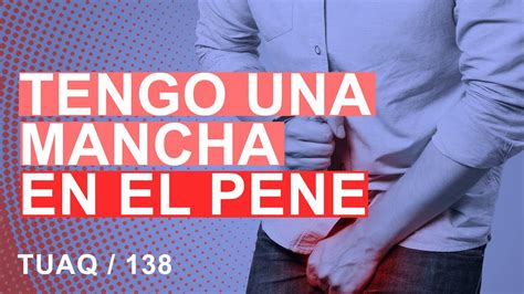 Manchas en el pene: causas y qué hacer